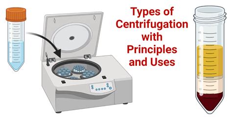 what does an ultracentrifuge do